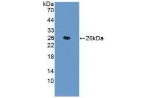 Figure. (Transgelin antibody  (AA 1-201))