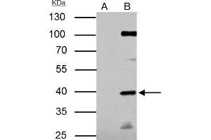IP Image E2F1 antibody [N1N3] immunoprecipitates E2F1 protein in IP experiments. (E2F1 antibody)