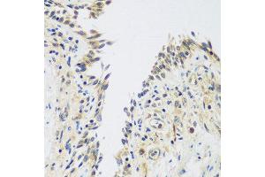Immunohistochemistry of paraffin-embedded human lung using UPF2 antibody at dilution of 1:100 (40x lens).