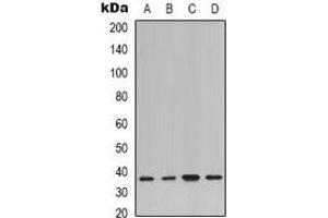 Western blot analysis of IKB alpha expression in K562 (A), Hela (B), NIH3T3 (C), rat kidney (D) whole cell lysates. (NFKBIA antibody  (N-Term))