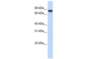 Glycogen Synthase 2 antibody used at 1 ug/ml to detect target protein.