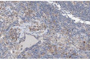 Immunohistochemistry (IHC) image for anti-SHC (Src Homology 2 Domain Containing) Transforming Protein 1 (SHC1) (pTyr349) antibody (ABIN6255897)
