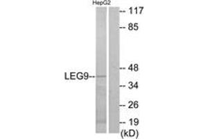 Western blot analysis of extracts from HepG2 cells, using LEG9 Antibody. (Galectin 9 antibody  (AA 51-100))