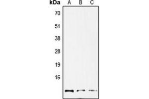 Western blot analysis of GNG12 expression in HepG2 (A), mouse lung (B), rat lung (C) whole cell lysates. (GNG12 antibody  (Center))