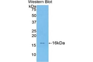 Detection of Recombinant TGFb1, Rat using Polyclonal Antibody to Transforming Growth Factor Beta 1 (TGFb1) (TGFB1 antibody  (AA 279-390))