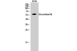Western Blotting (WB) image for anti-Glucosidase, beta (Bile Acid) 2 (GBA2) (Internal Region) antibody (ABIN3175282) (GBA2 antibody  (Internal Region))