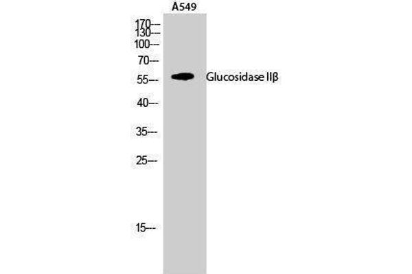 GBA2 antibody  (Internal Region)