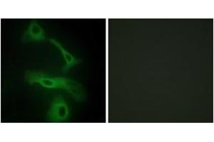 Immunofluorescence analysis of HeLa cells, using CLUS Antibody. (Clusterin antibody  (AA 400-449))