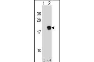 Western blot analysis of SUMO4 (arrow) using rabbit polyclonal SUMO4 Antibody (Center) (ABIN388077 and ABIN2845831). (SUMO4 antibody)