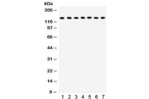 Western blot testing of 1) rat lung, 2) mouse lung, 3) HeLa, 4) MM231, 5) COLO320, 6) A549 and 7) mouse NIH3T3 lysate with SAP97 antibody.