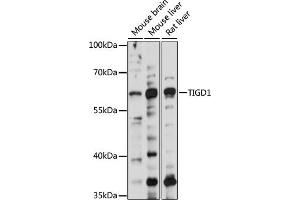 Western blot analysis of extracts of various cell lines, using TIGD1 antibody (ABIN7270828) at 1000 dilution. (TIGD1 antibody  (AA 1-300))