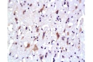Formalin-fixed and paraffin embedded: rat brain tissue labeled with Anti-PKB Polyclonal Antibody, Unconjugated 1:200 followed by conjugation to the secondary antibody and DAB staining (AKT1/3 (AA 401-479) antibody)