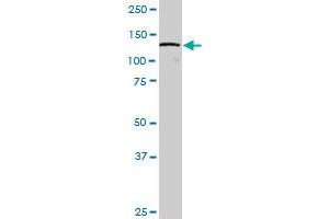 DDX42 MaxPab polyclonal antibody. (DDX42 antibody  (AA 1-819))