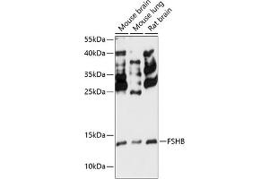 Western blot analysis of extracts of various cell lines, using FSHB antibody (ABIN7267225) at 1:3000 dilution.