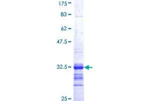 SSTR2 Protein (AA 316-369) (GST tag)