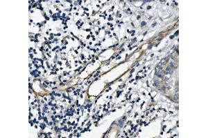 IHC analysis of CD31/PECAM1 using anti-CD31/PECAM1 antibody (ABIN7601076).