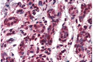 Human Breast (formalin-fixed, paraffin-embedded) stained with TCF3 antibody ABIN461942 at 3. (TCF3 antibody  (AA 522-535))