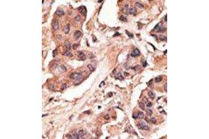 Image no. 2 for anti-Melanoma Antigen Family H, 1 (MAGEH1) (C-Term) antibody (ABIN358661) (MAGEH1 antibody  (C-Term))
