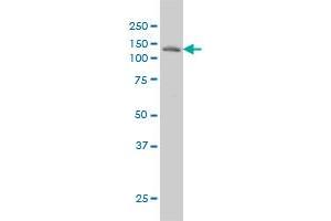 LAMB3 monoclonal antibody (M01), clone 2G10 Western Blot analysis of LAMB3 expression in A-431 . (Laminin beta 3 antibody  (AA 1064-1171))