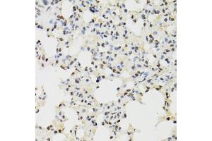 Immunohistochemistry of paraffin-embedded mouse lung using KDM4A antibody (ABIN6131821, ABIN6142793, ABIN6142795 and ABIN6223960) at dilution of 1:100 (40x lens). (KDM4A antibody  (AA 585-815))