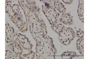 Immunoperoxidase of monoclonal antibody to SMC6L1 on formalin-fixed paraffin-embedded human placenta. (SMC6 antibody  (AA 1-110))