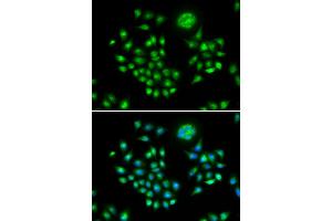 Immunofluorescence analysis of HeLa cells using AGFG1 antibody (ABIN6293682). (AGFG1 antibody)