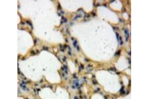 Used in DAB staining on fromalin fixed paraffin-embedded Lung tissue (TICAM2 antibody  (AA 34-241))