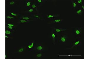 Immunofluorescence of purified MaxPab antibody to MYNN on HeLa cell. (Myoneurin antibody  (AA 1-610))