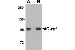 Western blot analysis of C-raf in 3T3 cell lysate with C-raf antibody at (A) 0. (RAF1 antibody  (N-Term))