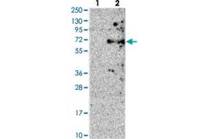Western blot analysis of Lane 1: Negative control (vector only transfected HEK293T lysate), Lane 2: Over-expression Lysate (Co-expressed with a C-terminal myc-DDK tag (~3. (ACRBP antibody)