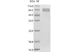 Alpha2 Antiplasmin (SERPINF2) (AA 28-491), (full length) protein (His tag)