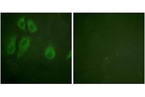 Immunofluorescence analysis of HeLa cells, using IL-2R alpha/CD25 (Ab-268) Antibody.