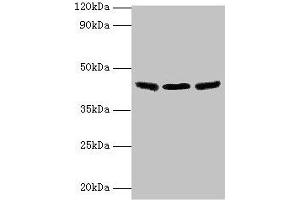 Western blot All lanes: IDH3B antibody at 2 μg/mL Lane 1: Hela whole cell lysate Lane 2: Mouse kidney tissue Lane 3: Mouse gonadal tissue Secondary Goat polyclonal to rabbit IgG at 1/10000 dilution Predicted band size: 43, 42, 26 kDa Observed band size: 43 kDa (IDH3B antibody  (AA 35-385))