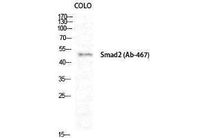 Western Blotting (WB) image for anti-SMAD, Mothers Against DPP Homolog 2 (SMAD2) (Ser80) antibody (ABIN3186987) (SMAD2 antibody  (Ser80))