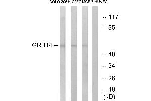 Western blot analysis of extracts from COLO cells, HUVEC cells and MCF-7 cells, using GRB14 antibody. (GRB14 antibody  (Internal Region))
