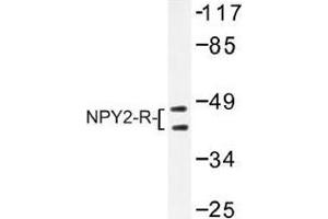 Image no. 1 for anti-Neuropeptide Y Receptor Y2 (NPY2R) antibody (ABIN317758) (NPY2R antibody)
