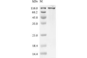 (Tris-Glycine gel) Discontinuous SDS-PAGE (reduced) with 5 % enrichment gel and 15 % separation gel.