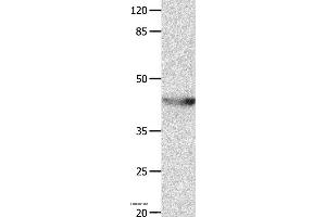 Western blot analysis of Mouse spleen tissue, using KCNA5 Polyclonal Antibody at dilution of 1:700 (KCNA5 antibody)