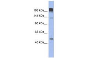 Image no. 1 for anti-Slit Homolog 3 (SLIT3) (AA 467-516) antibody (ABIN6744316) (SLIT3 antibody  (AA 467-516))