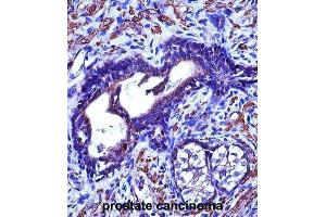 Immunohistochemistry (IHC) image for anti-Actin, gamma 2, Smooth Muscle, Enteric (ACTG2) antibody (ABIN2997383) (ACTG2 antibody)