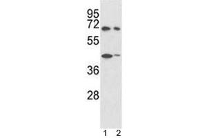PTPN11 Antibody (ABIN3032394)