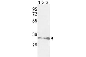 Western blot analysis of anti-PCNA antibody and Jurkat (lane 1), HeLa (2), 293 (3) lysate (PCNA antibody  (AA 89-117))