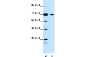 Western Blotting (WB) image for anti-Tripartite Motif Containing 32 (TRIM32) antibody (ABIN2461827) (TRIM32 antibody)