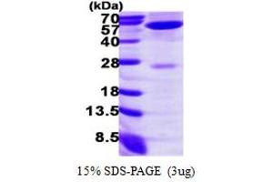 SDS-PAGE (SDS) image for Alanine Aminotransferase (ALT) (AA 1-496) protein (His tag) (ABIN667978) (ALT Protein (AA 1-496) (His tag))