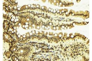 ABIN6269043 at 1/100 staining Mouse colon tissue by IHC-P. (CHEK1 antibody  (Internal Region))