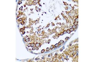 Immunohistochemistry of paraffin-embedded rat testis using T Rabbit mAb (ABIN7270916) at dilution of 1:100 (40x lens). (TACC3 antibody)