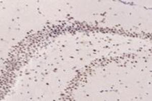 Immunohistochemistry (Paraffin-embedded Sections) (IHC (p)) image for anti-Transcriptional Adaptor 2B (TADA2B) antibody (ABIN7075957)
