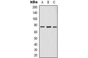 Western blot analysis of GAB1 expression in K562 (A), HepG2 (B), NIH3T3 (C) whole cell lysates. (GAB1 antibody  (C-Term))