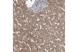 Immunohistochemical staining of human liver with MED12L polyclonal antibody  shows moderate cytoplasmic and nucleolar positivity in hepatocytes at 1:50-1:200 dilution.