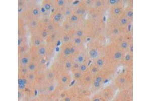 Figure. (SNX17 antibody  (AA 1-195))